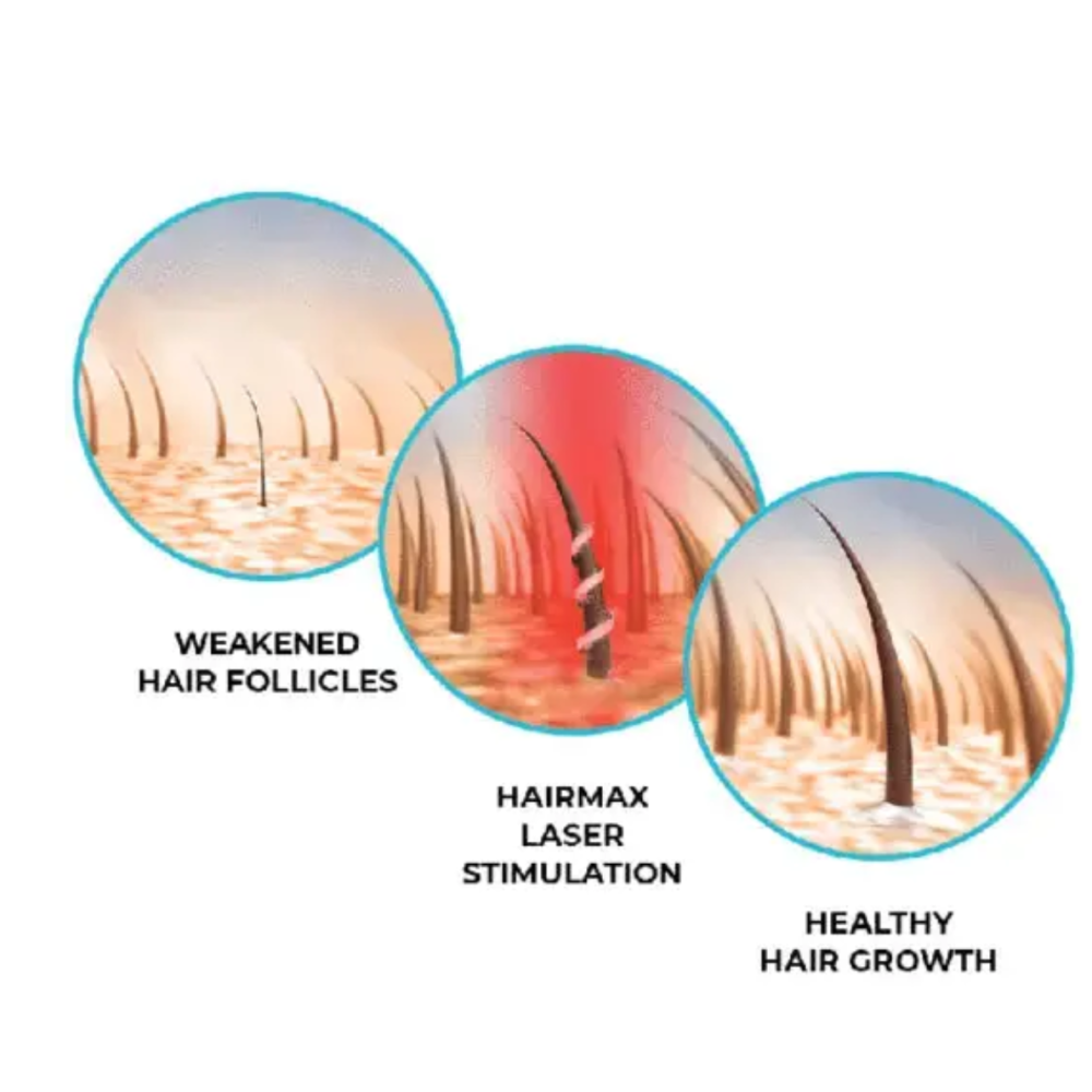 HairMax LaserCap 272 PowerFlex – lazerinė kepurė (LASER 272)