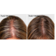 HairMax LaserBand 82 - ComfortFlex lazerinė šukų juosta, rožinio aukso (16970-rose-gold)