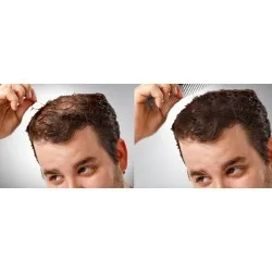 HAIR EFFECT Medium Brown 5-6 – plaukų skaidulų pudra, vidutinės rudos spalvos, 26 g